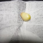 bur-sarımsak boğazına takıldı